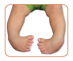 clawed foot